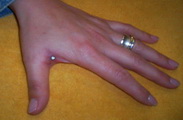 Piercingstudio Piercingschmuck Alzey